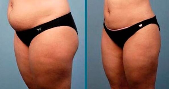 Comment perdre 10 kg en un mois